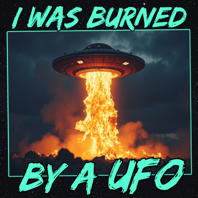 episode I Was Burned by a UFO artwork