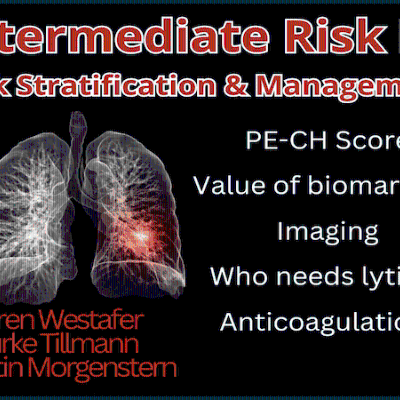 episode Ep 203 Intermediate Risk Pulmonary Embolism Risk Stratification, Management and Algorithm artwork