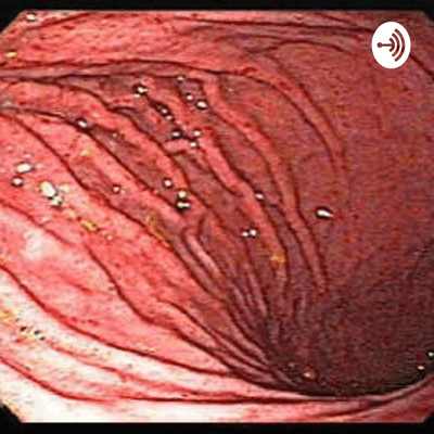 Historia clinica (Gastritis)