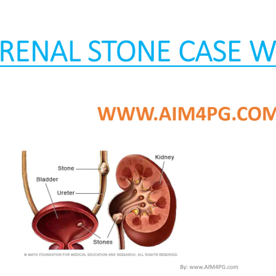 episode CLINICAL CASE PRESENTATION OF RENAL / KIDNEY STONE WITH NOTES artwork