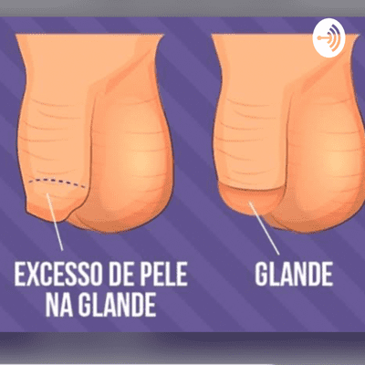 episode Fimose infantil artwork