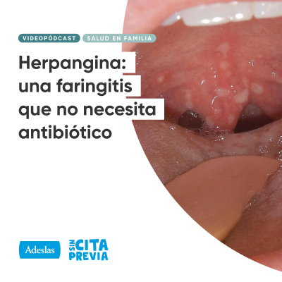 episode 198 Herpangina: una faringitis que no necesita antibiótico artwork