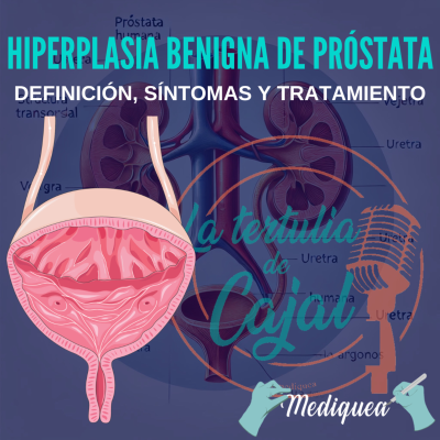 episode #36 Hiperplasia Benigna de Próstata - Podcast MIR artwork