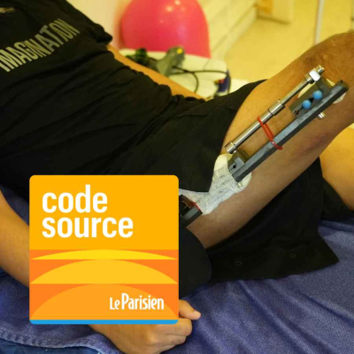 episode Allongement des jambes en Turquie : notre reporter raconte cette tendance risquée artwork
