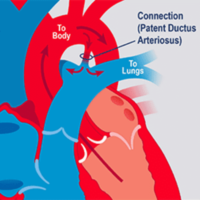 episode EP1.2 : Cardiovascular System - PJB asianotik (PDA) artwork