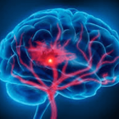 episode Neuropatologías artwork