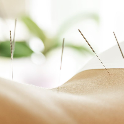 episode Acupuncture for Your Good Health! artwork