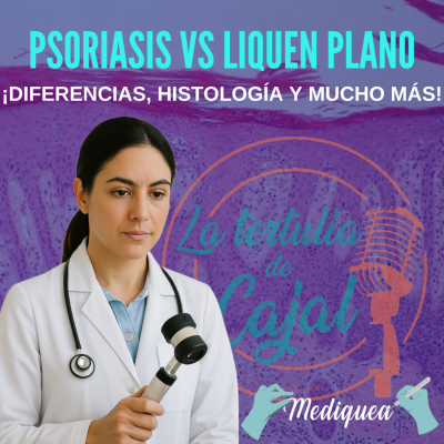 episode #45 Psoriasis vs Liquen plano - Podcast MIR artwork