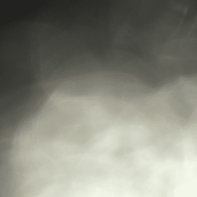 episode Pros and Cons of the Olympic Games artwork