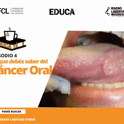 episode Educa Té | Lo que debés saber del cáncer oral artwork