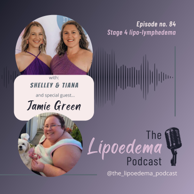 episode Ep. 84 ~ Stage 4 Lipoedema Warrior Jamie Green artwork