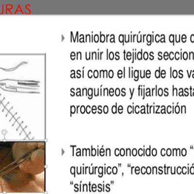 episode Suturas Quirúrgicas interrumpidas artwork