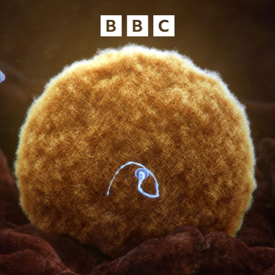 episode Cancer-causing gene found in donor sperm across Europe artwork