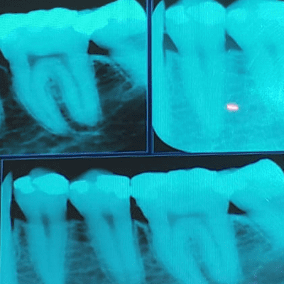 episode A2 micro oral artwork