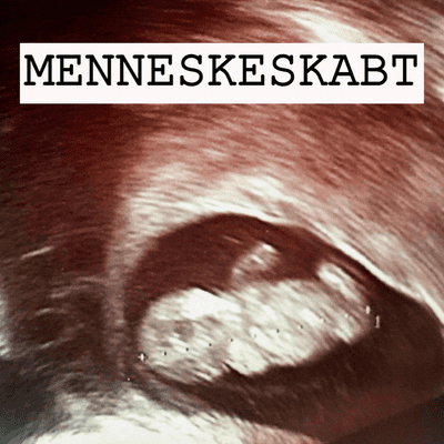 MENNESKESKABT