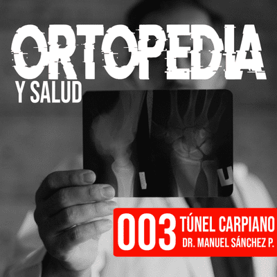 episode 003. Síndrome del túnel carpiano - Dr. Manuel Sánchez Prado artwork