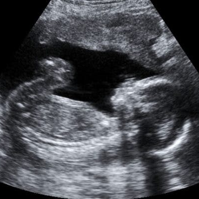 episode Seeking Support: Miscarriage and Infant Loss artwork