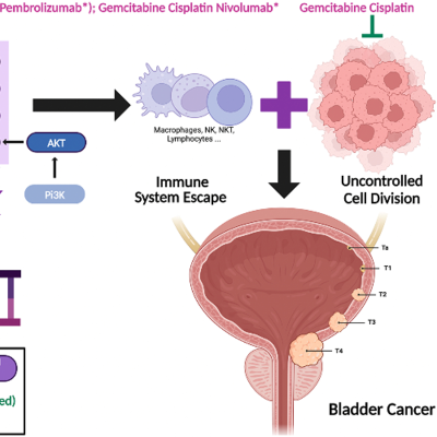 episode New Drug Combination Redefines First-Line Treatment for Advanced Urothelial Cancer artwork
