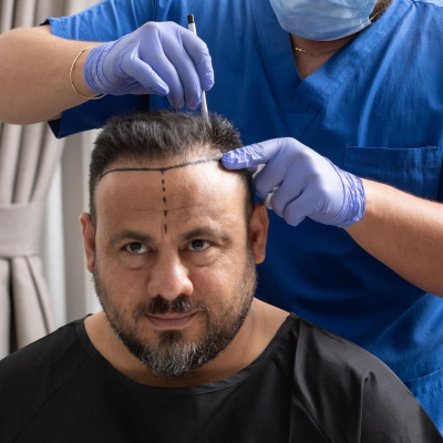 episode Schluss mit Glatze - Haartransplantationen in der Türkei artwork