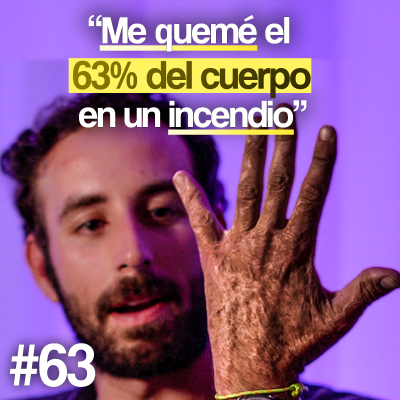 episode Llevo piel de laboratorio tras el incendio - Álvaro Trigo | Un Propósito #63 artwork