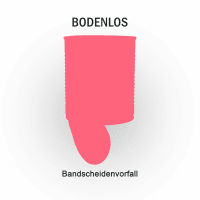episode Bandscheidenvorfall artwork