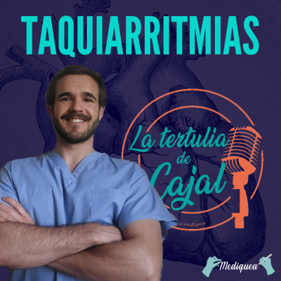 episode #32 Taquiarritmias - Podcast MIR artwork