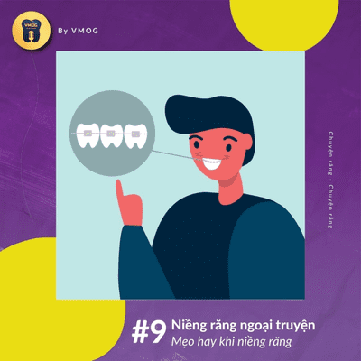 episode S1E9: Niềng răng ngoại truyện #9 - Mẹo hay khi niềng răng artwork