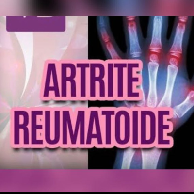 episode Artrite reumatoide artwork