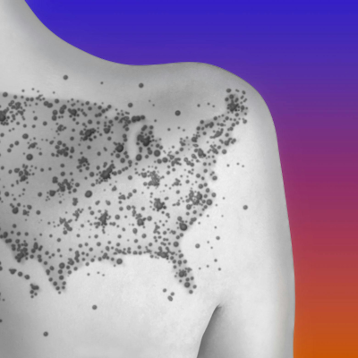 episode What Next: TBD | Hot Measles Summer artwork
