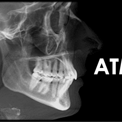 episode Articulación temporomandibular artwork