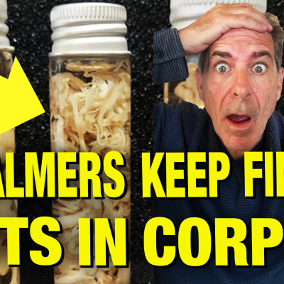 episode Embalmers Report Persistent Blood Clots in Corpses Since COVID Vaxx Roll Out! artwork