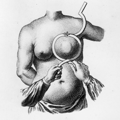 episode Krebs - Der Angstgegner artwork