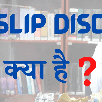 episode Slip Disc क्या है? , What is Slip Disc? Facts Explained in हिंदी - Spine Surgery | Dr. Hitesh Garg artwork