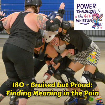 episode 170 - Bruised but Proud: Finding Meaning in the Pain artwork