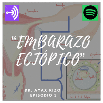 episode Embarazo ectópico, la importancia del diagnóstico oportuno. artwork