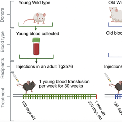 episode Young and Old Mice Blood Differently Shapes Alzheimer’s-Related Brain Changes artwork