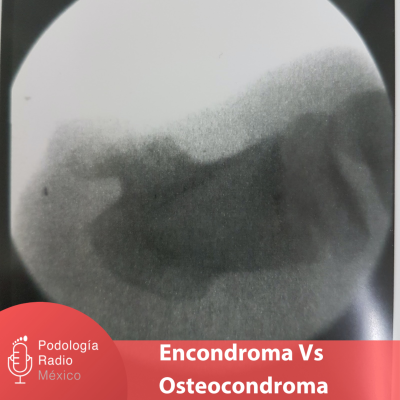 episode Encondroma Vs Osteocondroma artwork